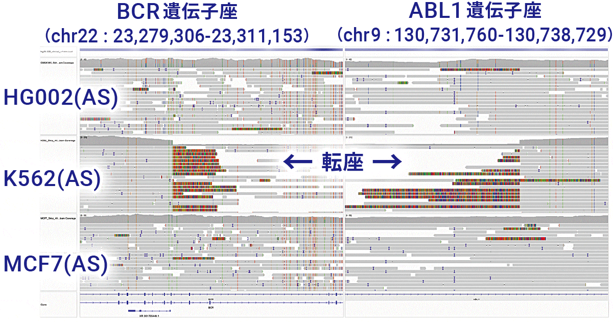 融合遺伝子検出例(BCR::ABL1融合遺伝子t(9;22))